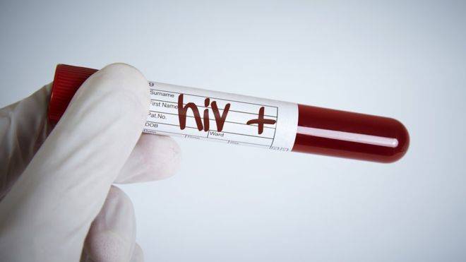 Tratamiento experimental contra el VIH